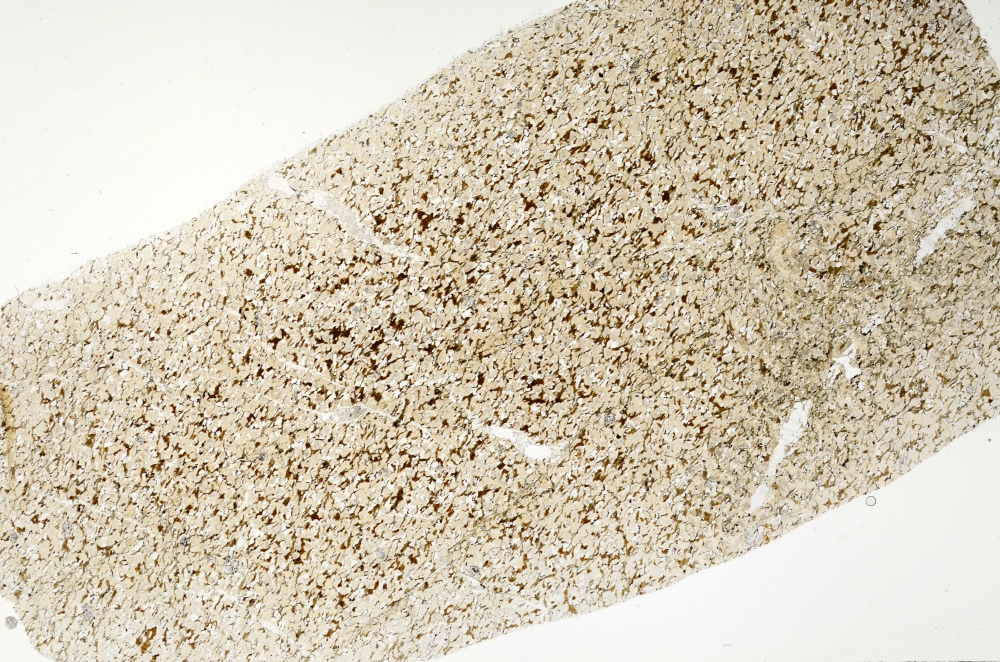 Plane Polarized, S71392