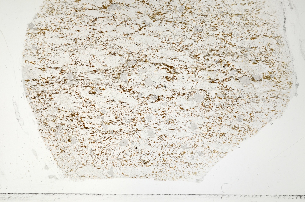 Plane Polarized, S71393