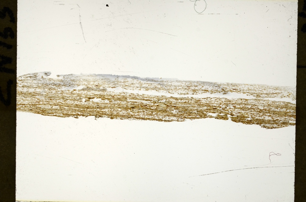 Plane Polarized, S72486