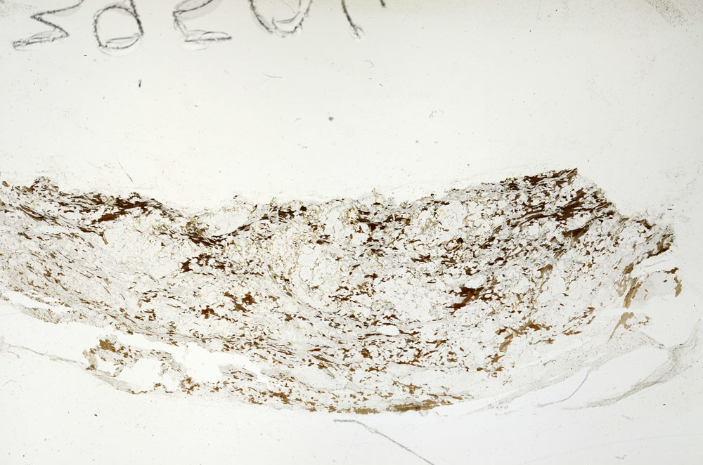 Plane Polarized, S88266