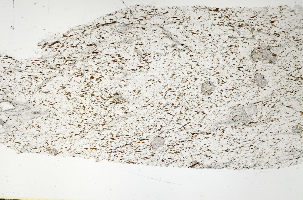 Plane Polarized, S88535