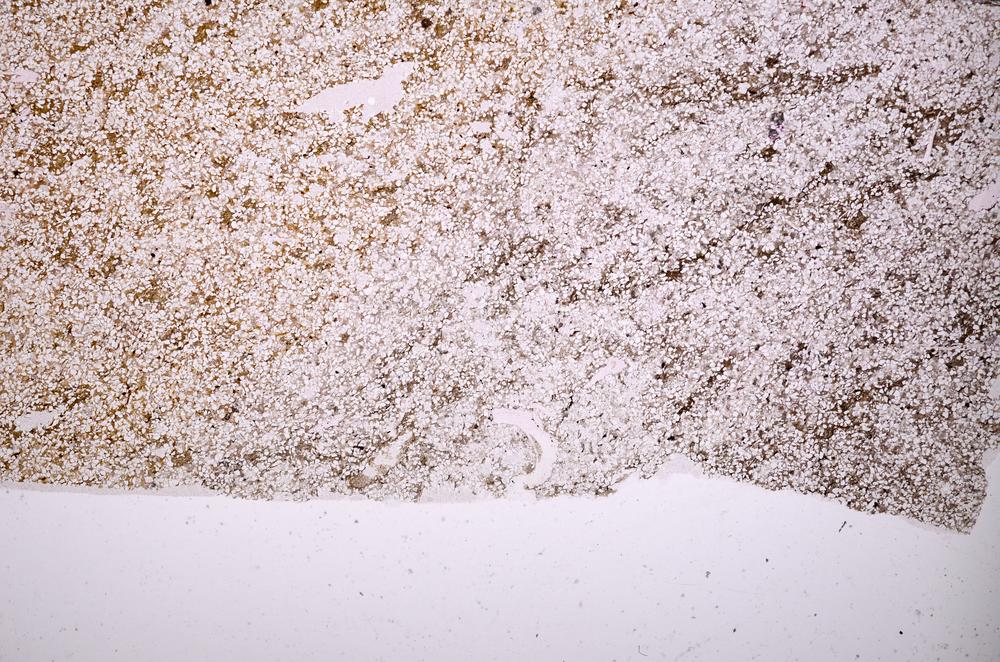 Plane Polarized, E40157